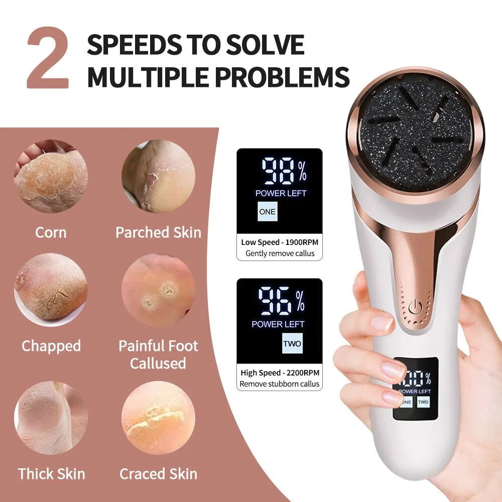 Rechargeable Callus Remover