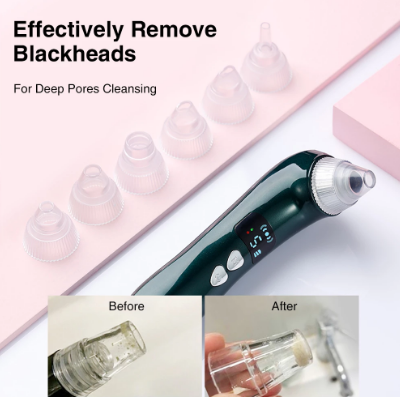 Vacuum Blackhead Remover