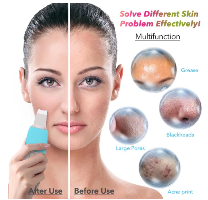 Ultrasonic Facial Cleaner